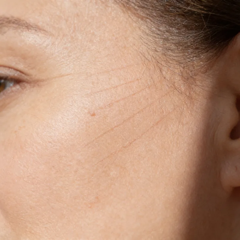 Close-up of skin at the temple in soft daylight, with faint fine lines fanning across the frame.