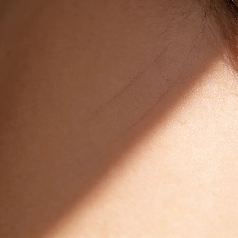 Facial skin in raking light, its natural texture and pores described by shadow.